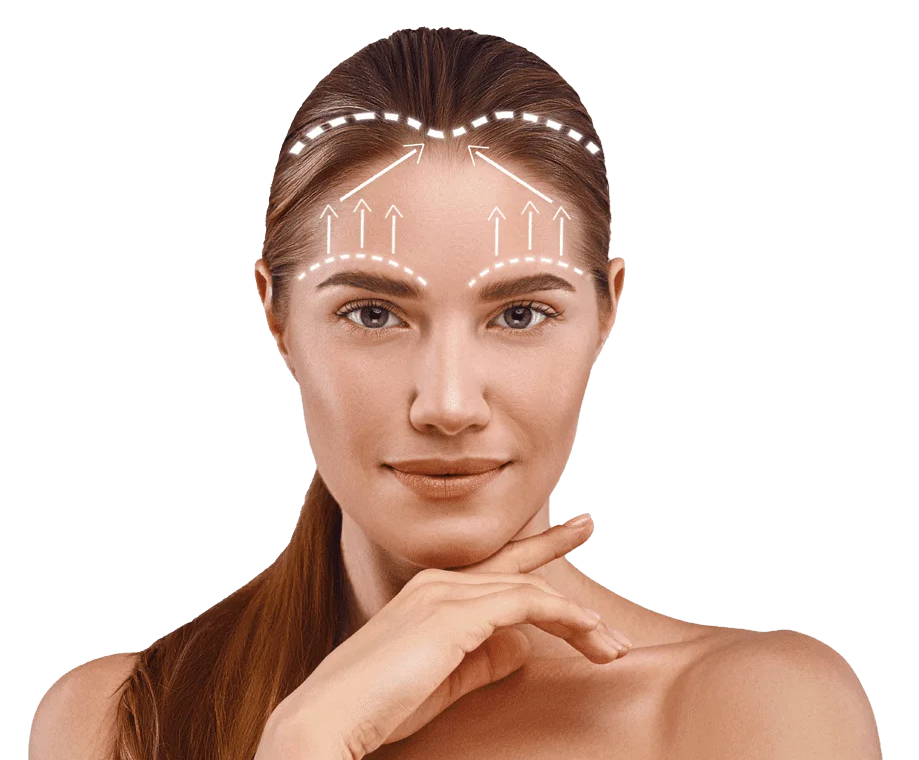 Forehead Lift Surgery in Turkey