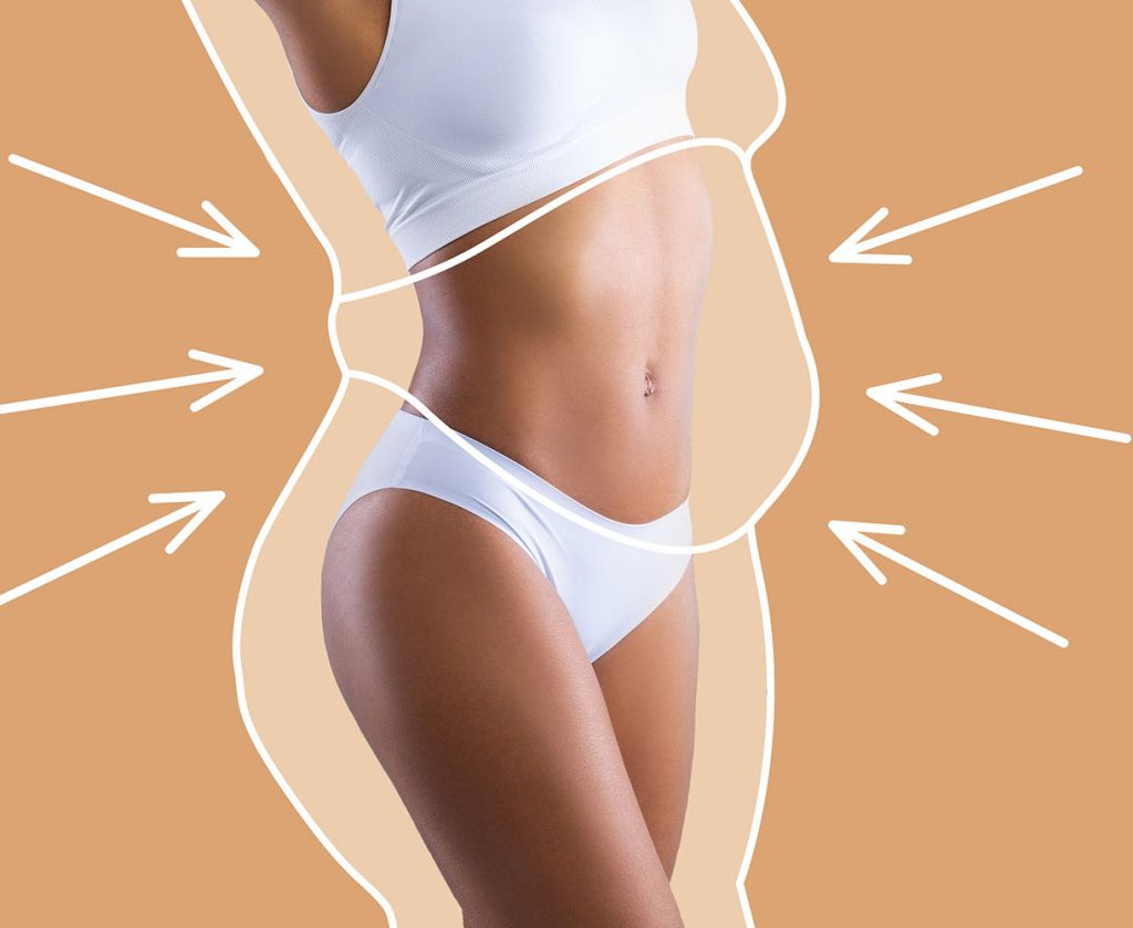 Liposuction