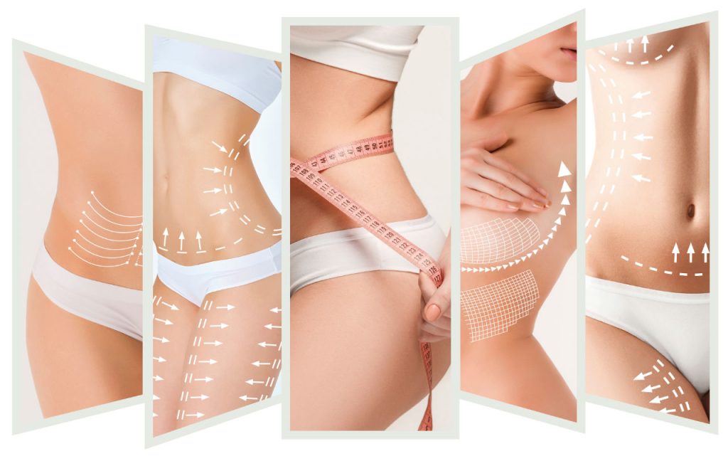 Body Aesthetics in Turkey