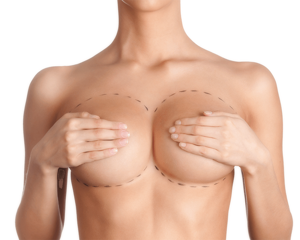 Breast Asymmetry Surgery in Turkey