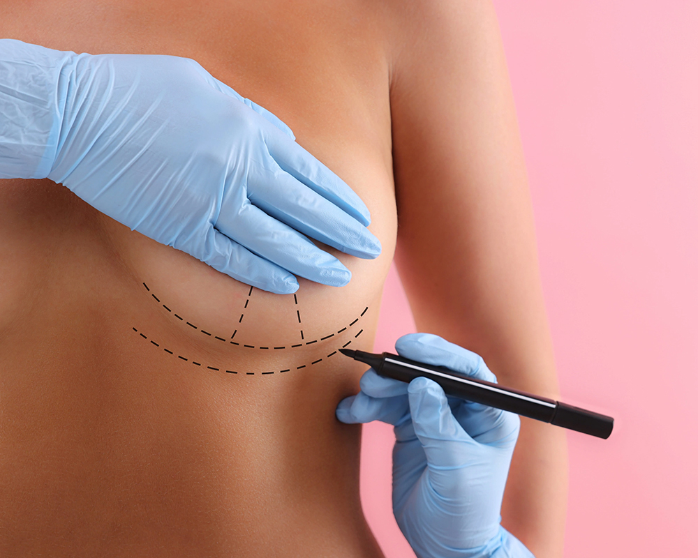 Breast Augmentation Surgery in Turkey