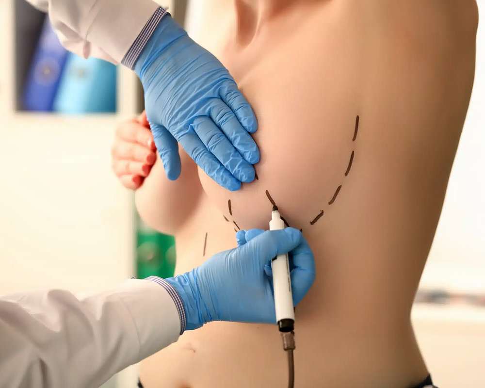 Breast Reduction Surgery in Turkey