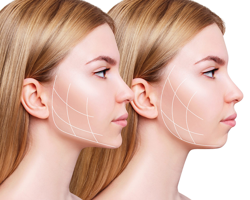 Chin Aesthetics in Turkey