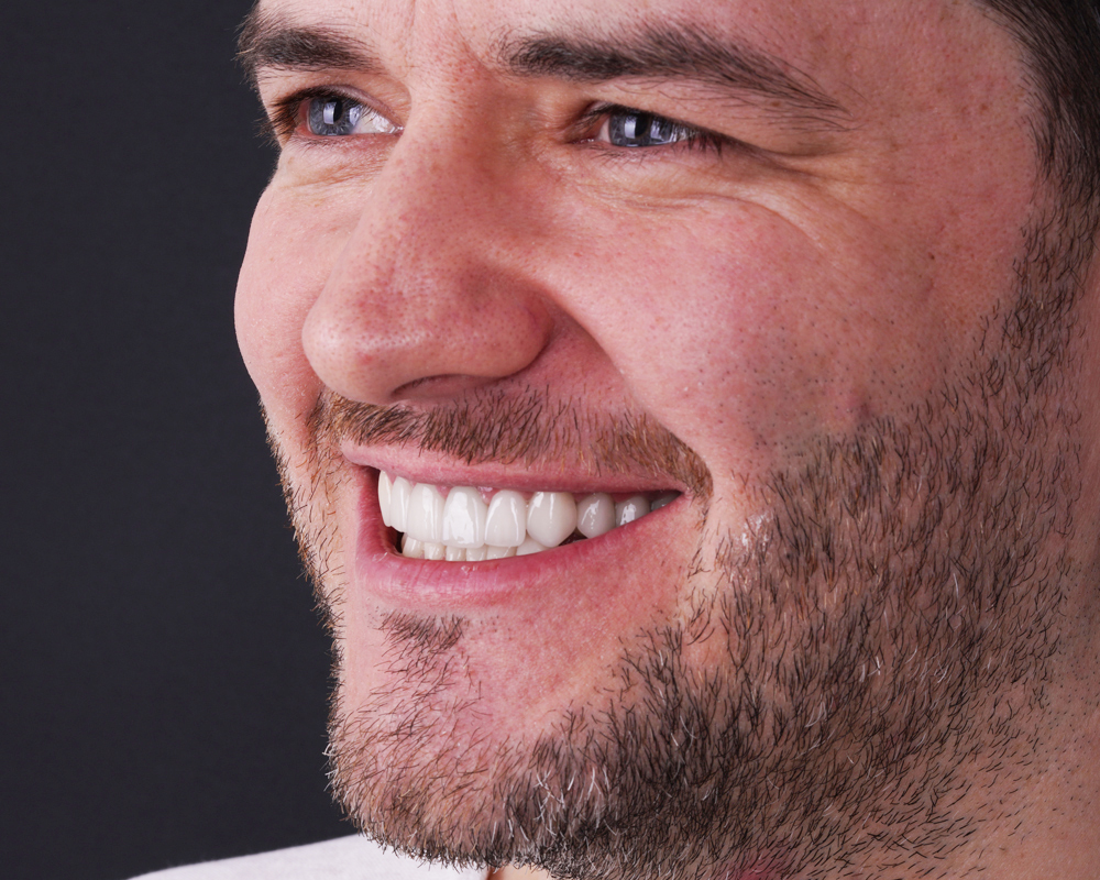 Dental Crowns in Turkey